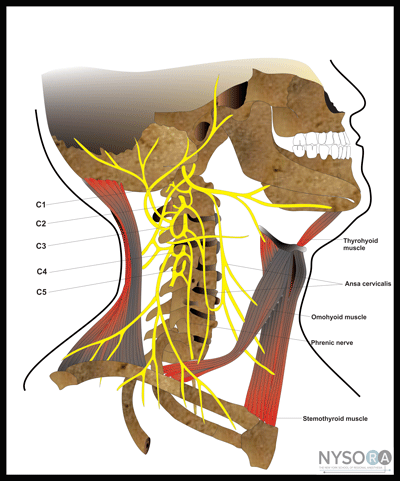 cervical plexus block nysora the new york school of cervical muscles