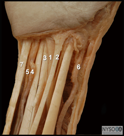 Wrist Block - NYSORA The New York School of Regional Anesthesia