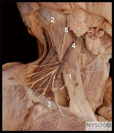 Ultrasound-Guided Superficial Cervical Plexus Block - NYSORA The New