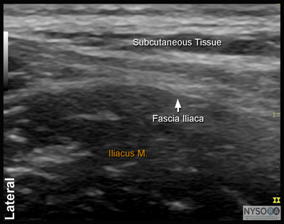 nysora - the new york school of regional anesthesia - ultrasound nysora - the new york school of regional anesthesia - ultrasound, Muscles