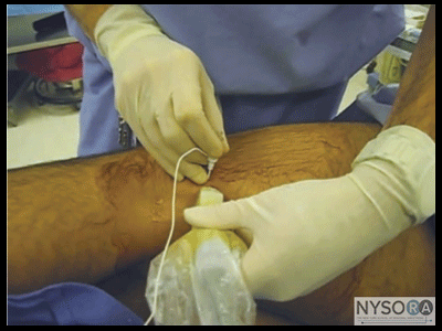 dialysis system on the market in south africa dialysis system ebay