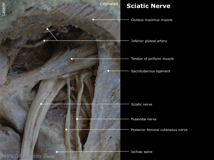 Nerve Block: Nysora Sciatic Nerve Block