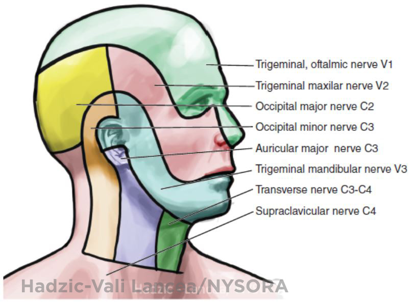 Ultrasound Guided Cervical Plexus Block Nysora The New York School Of