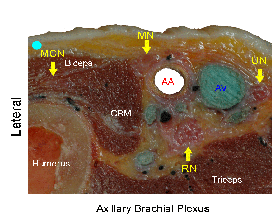Axillary Brachial Plexus_Transducer position, US images and Crossection
