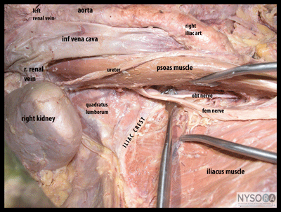 Essentials of Regional Anesthesia Anatomy - NYSORA The New York School