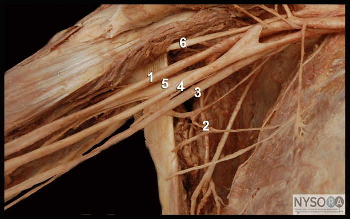 Cutaneous Nerve blocks of the Upper Extremity - NYSORA The New York