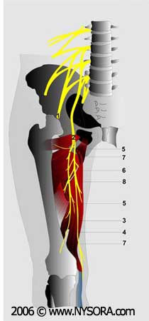 Obturator Nerve Block - NYSORA The New York School of Regional Anesthesia