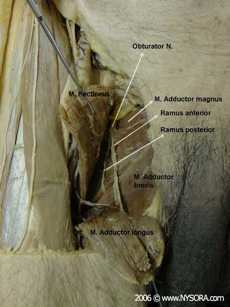 Obturator Nerve Block - NYSORA The New York School of Regional Anesthesia