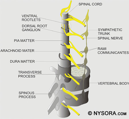 Spinal Anesthesia - NYSORA The New York School of Regional Anesthesia
