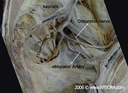 Obturator Nerve Block - NYSORA The New York School of Regional Anesthesia