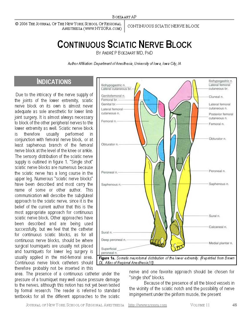 https://www.nysora.com/wp-content/uploads/2013/10/continuous_sciatic_nerve_block_NYSORA.jpg