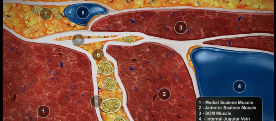 UltrasoundGuided Interscalene Brachial Plexus Block Video NYSORA The