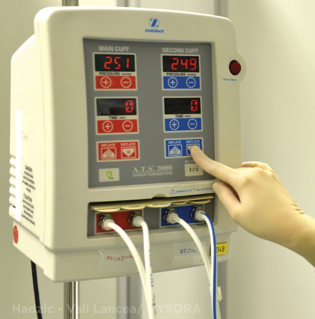 Intravenous Regional Block for Upper and Lower Extremity Surgery