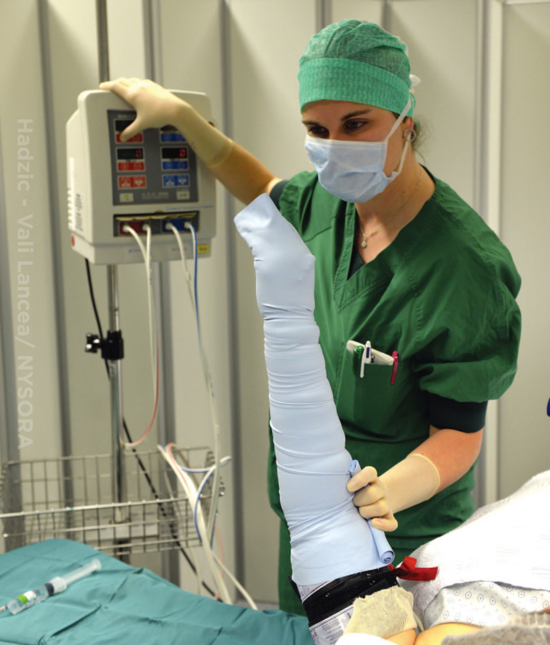 Intravenous Regional Block for Upper and Lower Extremity Surgery