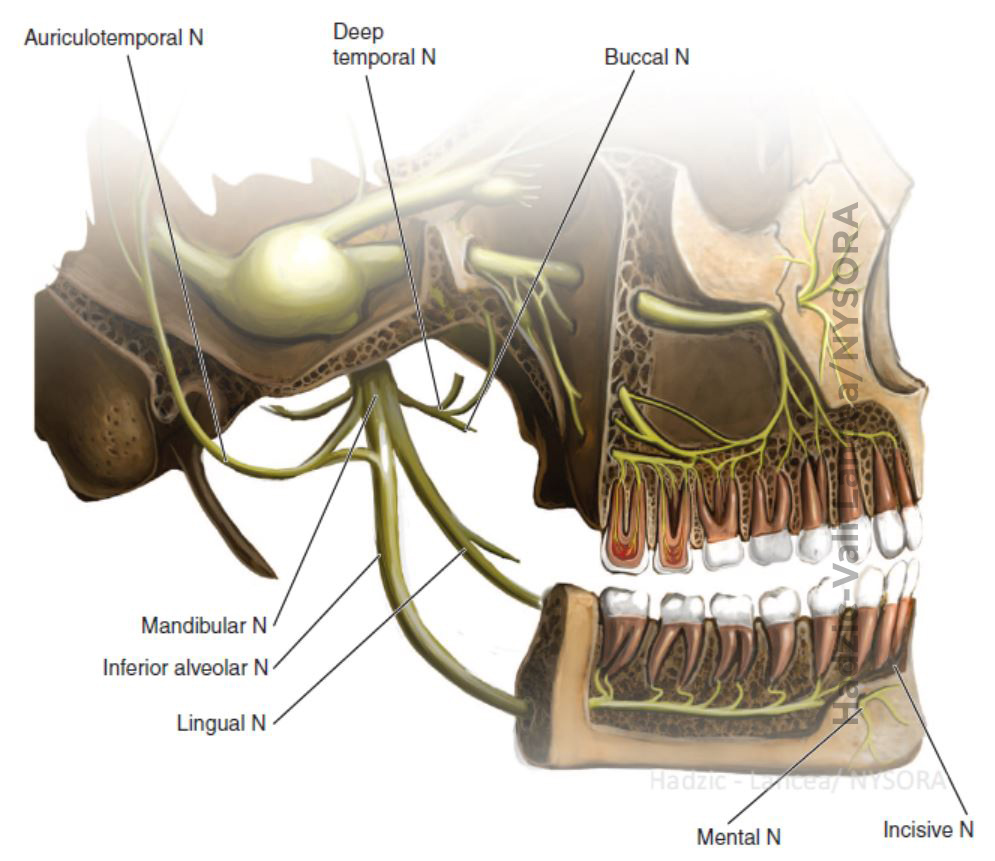 inferior alveolar nerve block