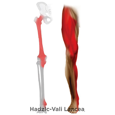 Ultrasound-Guided Fascia Iliaca Block - NYSORA The New York School of ...