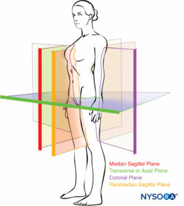 Conventional body planes