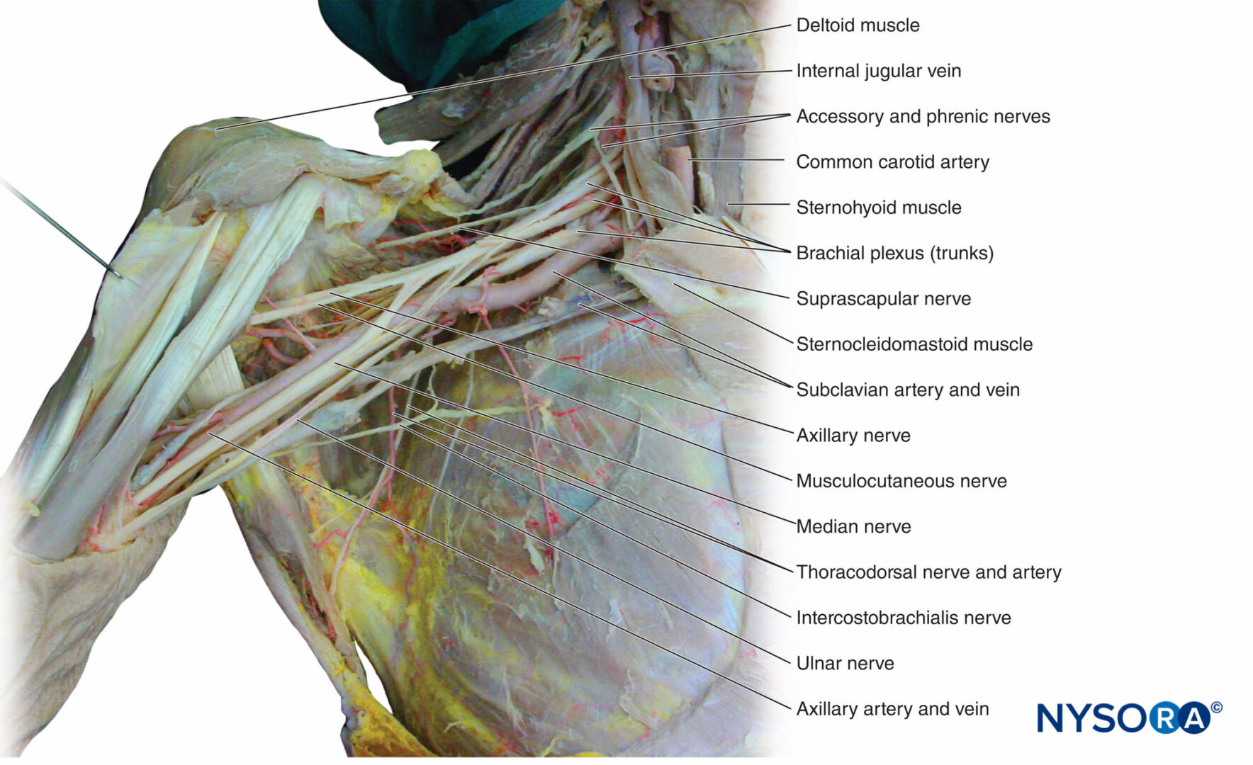 Functional Regional Anesthesia Anatomy Nysora