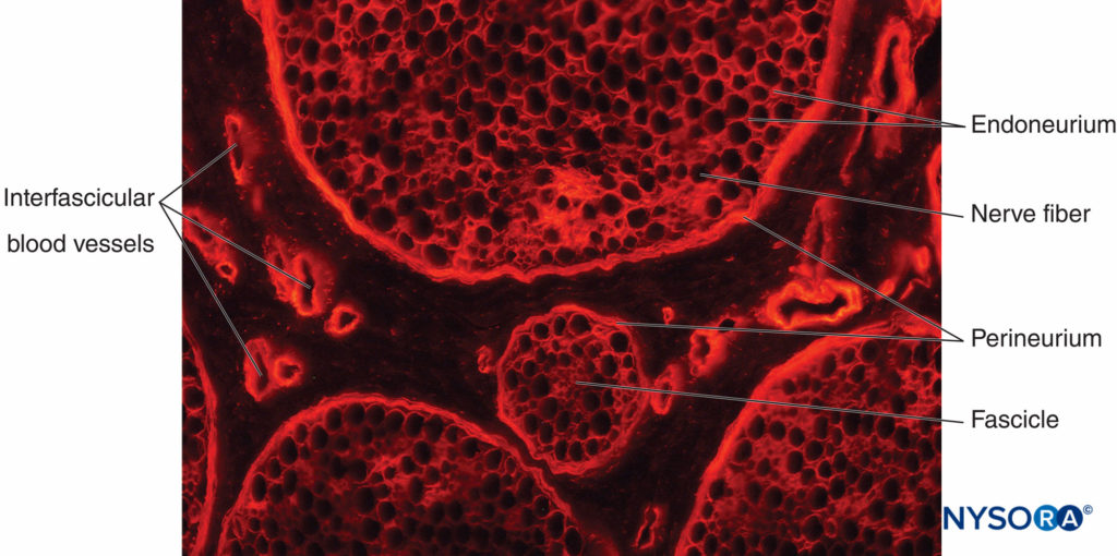 Transverse section of pig sciatic nerve. Immunohistochemical staining for collagen. Blood vessels course through the interfascicular epineurium, which fills the space around the perineurium and fascicles.