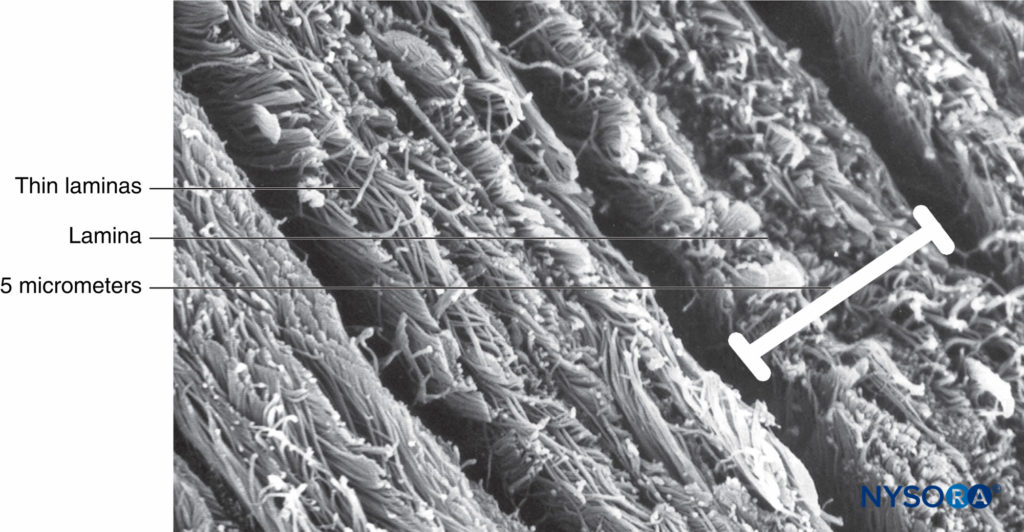 Partial thickness of the dural sac. Details of dural laminas. Scanning electron microscopy. Magnification ×4,000. (Reproduced with permission from Reina MA, López A, Dittmann M, et al: Structure of human dura mater thickness by scanning electron microscopy. Rev Esp Anestesiol Reanim. 1996 Apr;43(4):135-137.)