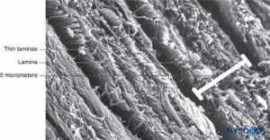 Anatomie ultrastructurale des méninges spinales et des structures ...