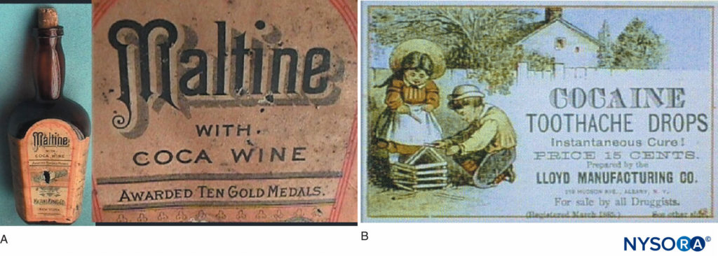 Examples of products that incorporated cocaine during the time before it became a controlled substance. Wines fortified with cocaine were particularly popular as “tonics.” (Used with permission from Addiction Research Unit, University of Buffalo.)