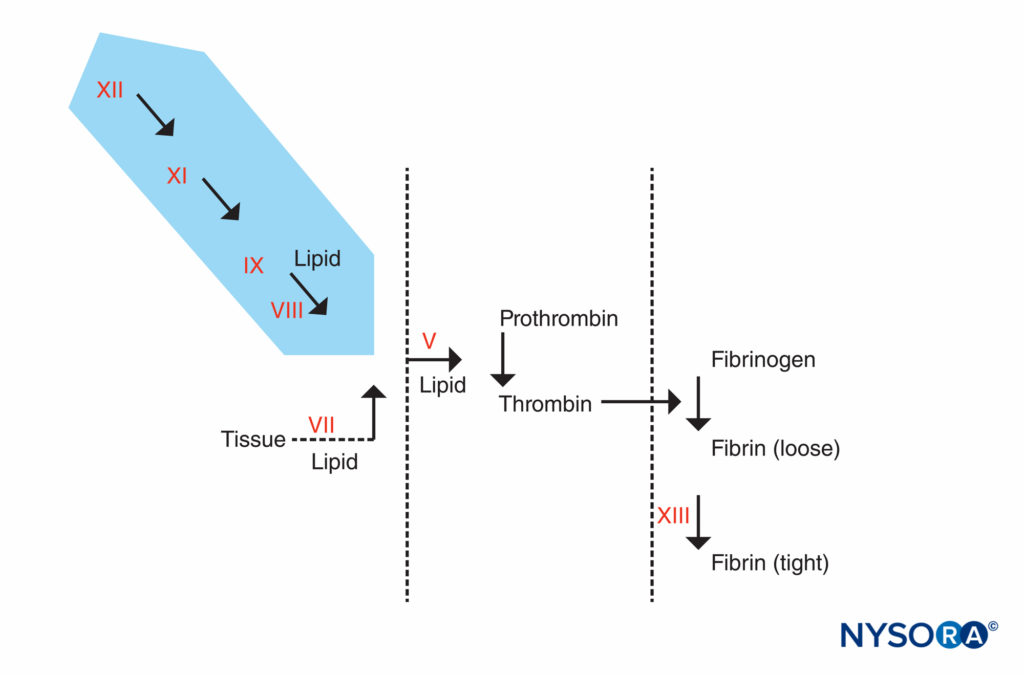 Coagulation reaction. Factors responsible for a prolonged PTT are in the shaded area. Patients who have an abnormal PTT but whose PT and other tests are normal can be divided into 2 groups: those who are prone to bleeding and those who are not. The patients who do not bleed may have an extremely prolonged PTT (90 seconds or more) but do not have a history of bleeding. They will have a deficiency in factor XII, prekalikrein, or high-molecular-weight kininogen. These patients should not be denied surgery or epidural anesthesia. The other group, patients who bleed, have both prolonged PTT and a history of bleeding. They will have a deficiency of factor VIII (hemophilia A), factor IX (hemophilia B or Christmas disease), or factor XI.