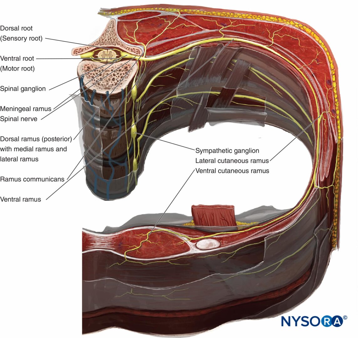 Thoracic and Lumbar Paravertebral Block - Landmarks and ...