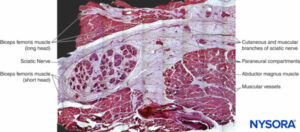 Sciatic nerve and its surrounding paraneurium at the level of the popliteal fossa. Hematoxylin-eosin. (Reproduced with permission from Reina MA: Atlas of Functional Anatomy for Regional Anesthesia and Pain Medicine. New York: Springer; 2015.)
