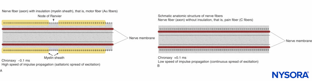 Schematic anatomic structures of nerve fibers. A: Nerve fiber (axon) with insulation (myelin sheath), (Aα fibers). B: Nerve fiber (axon) without insulation (C fiber).