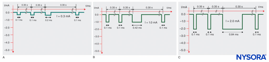 Sequential Electrical Nerve Stimulation (SENSe) impulse pattern of the Stimuplex HNS 12 nerve stimulator (B. Braun, Melsungen, Germany) depending on the actual stimulus amplitude. The impulse duration of the third impulse decreases with the stimulus amplitude below 2.5 mA from 1.0 ms to a minimum of 0.2 ms compared to the constant impulse duration of 0.1 ms of the first two impulses. A: Impulse pattern at 0.3 mA (threshold level). B: Impulse pattern at 1.0 mA. C: Impulse pattern at 2.0 mA.