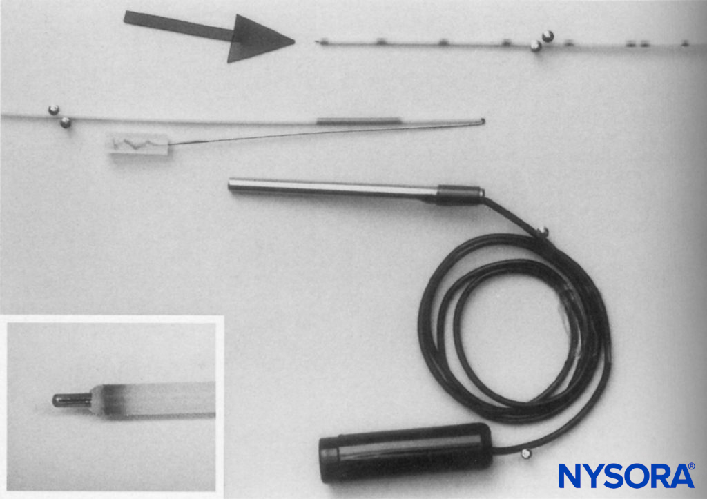 Shortened catheter with stylet just protruding from the distal end (inset) and folded over to maintain the position at the proximal end. Electrical connection is made by sliding a firmly fitting metal tube over the proximal end of the catheter. (Reproduced with permission from Sutherland ID: Continuous sciatic nerve infusion: expanded case report describing a new approach. Reg Anesth Pain Med. 1998 Sep-Oct;23(5):496-501.)