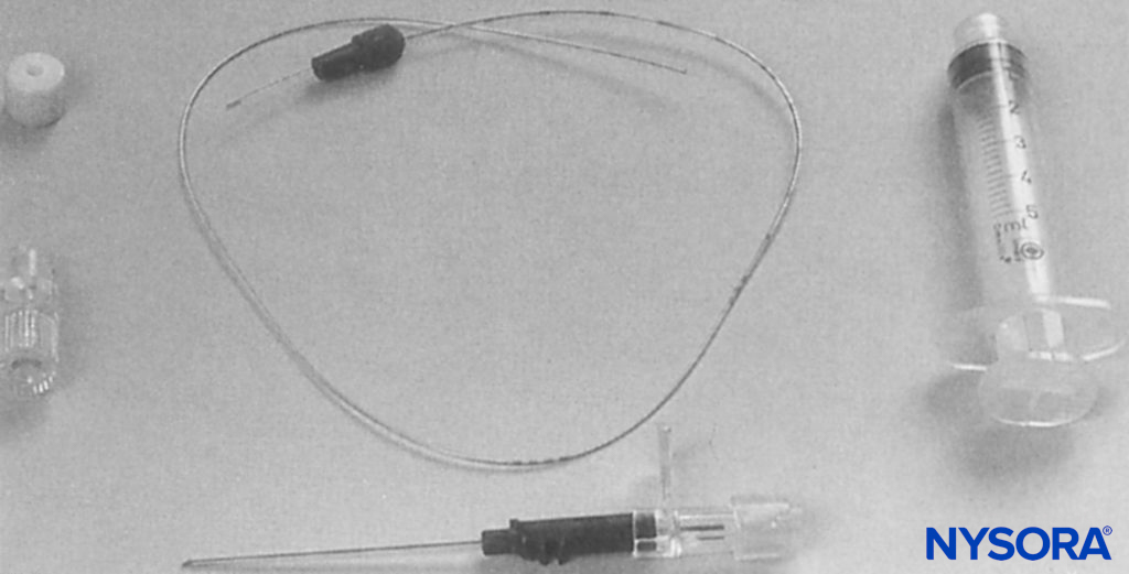 Brachial plexus infusion kit as used in this study (Contiplex®, B. Braun Australia Pty. Ltd.). The introducing cannula is 18 gauge, with a 0.85-mm diameter catheter, which is threaded into the axillary brachial plexus sheath. The needle within the cannula is a short-bevel type (30°). (Reproduced with permission from Mezzatesta JP, Scott DA, Schweitzer SA, et al: Continuous axillary brachial plexus block for postoperative pain relief. Intermittent bolus versus continuous infusion. Reg Anesth. 1997 Jul-Aug;22(4):357-362.)