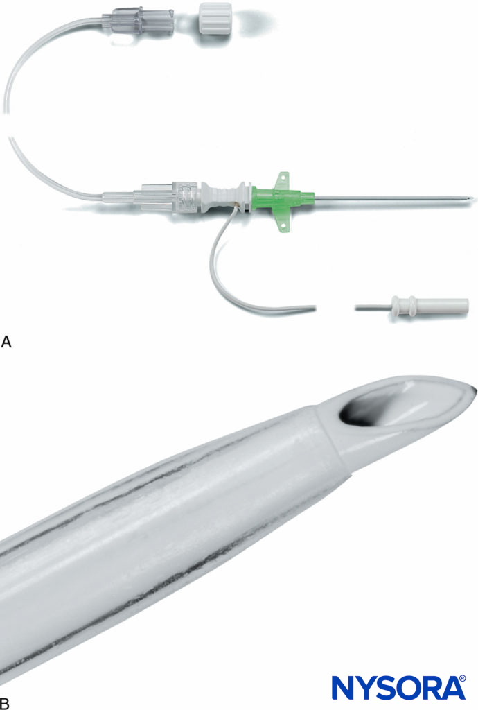 Arrow single-shot or continuous brachial plexus catheter. (Reproduced with permission from Longo SR, Williams DP: Bilateral fascia iliaca catheters for postoperative pain control after bilateral total knee arthroplasty: a case report and description of a catheter technique. Reg Anesth. 1997 Jul-Aug;22(4):372-377.)