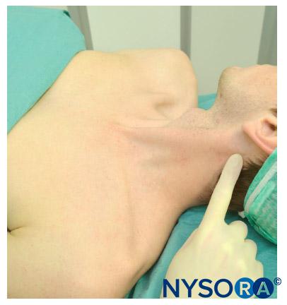 Palpation of the mastoid process.