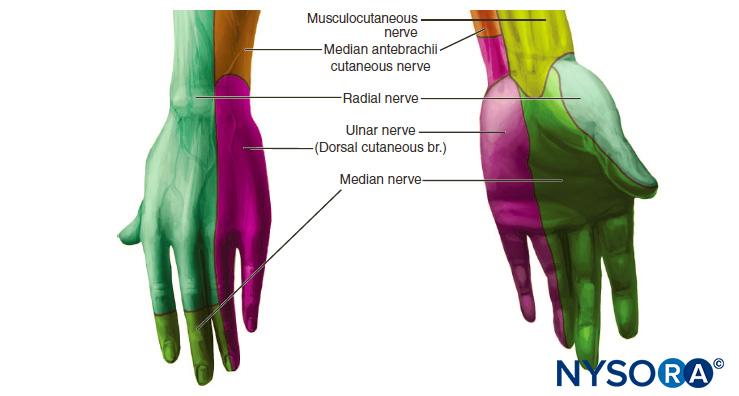 Wrist Block - Landmarks and Nerve Stimulator Technique - NYSORA