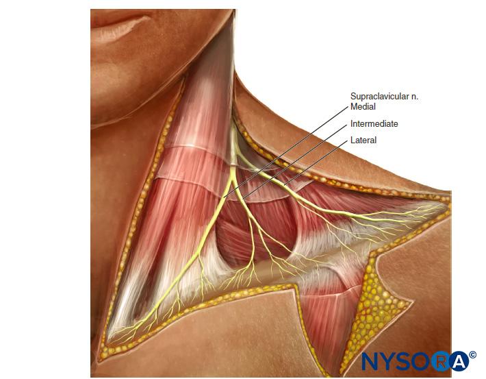 Supraclavicular nerves, derived from C3–C4 nerve roots, is not part of the brachial plexus, and provides sensory innervation of the shoulder “cape.”