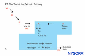 Coagulation reaction. Factors involved in PT are in the shaded area. The PT is carried out by adding a source of tissue factor to the patient’s plasma along with calcium or phospholipid. Tissue factor forms a complex with and activates factor VII. (Ca, calcium; PL, phospholipid.)