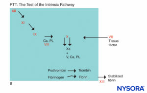 Coagulation reaction. Factors involved in PTT are in the shaded area. In assessing PTT, coagulation is initiated by an agent that activates the Hageman factor–kininogen–prekalikrein complex. Most coagulation factors are screened by PTT, except factors VII and XIII, the protein that stabilizes fibrin clots by cross-linking them, and components of the fibrinolytic system. (Ca, calcium; PL, phospholipid.)