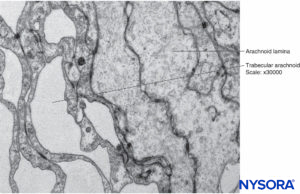 Arachnoid cells in the thickness of arachnoid layer. Transmission electron microscopy. Magnification ×40,000.