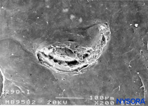 Dura-arachnoid lesion produced with 29-G Quincke needle. Arachnoid surface. Scanning electron microscopy. Magnification ×200. (Reproduced with permission from Reina MA, Castedo J, López A. Cefalea pospunción dural: Ultraestructura de las lesiones durales y agujas espinales usadas en las punciones lumbares. Rev Arg Anestesiol. 2008 Jan-Mar 66(1):6-26.