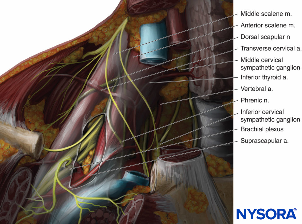 Anatomy of the brachial plexus at the low interscalene space and supraclavicular area.