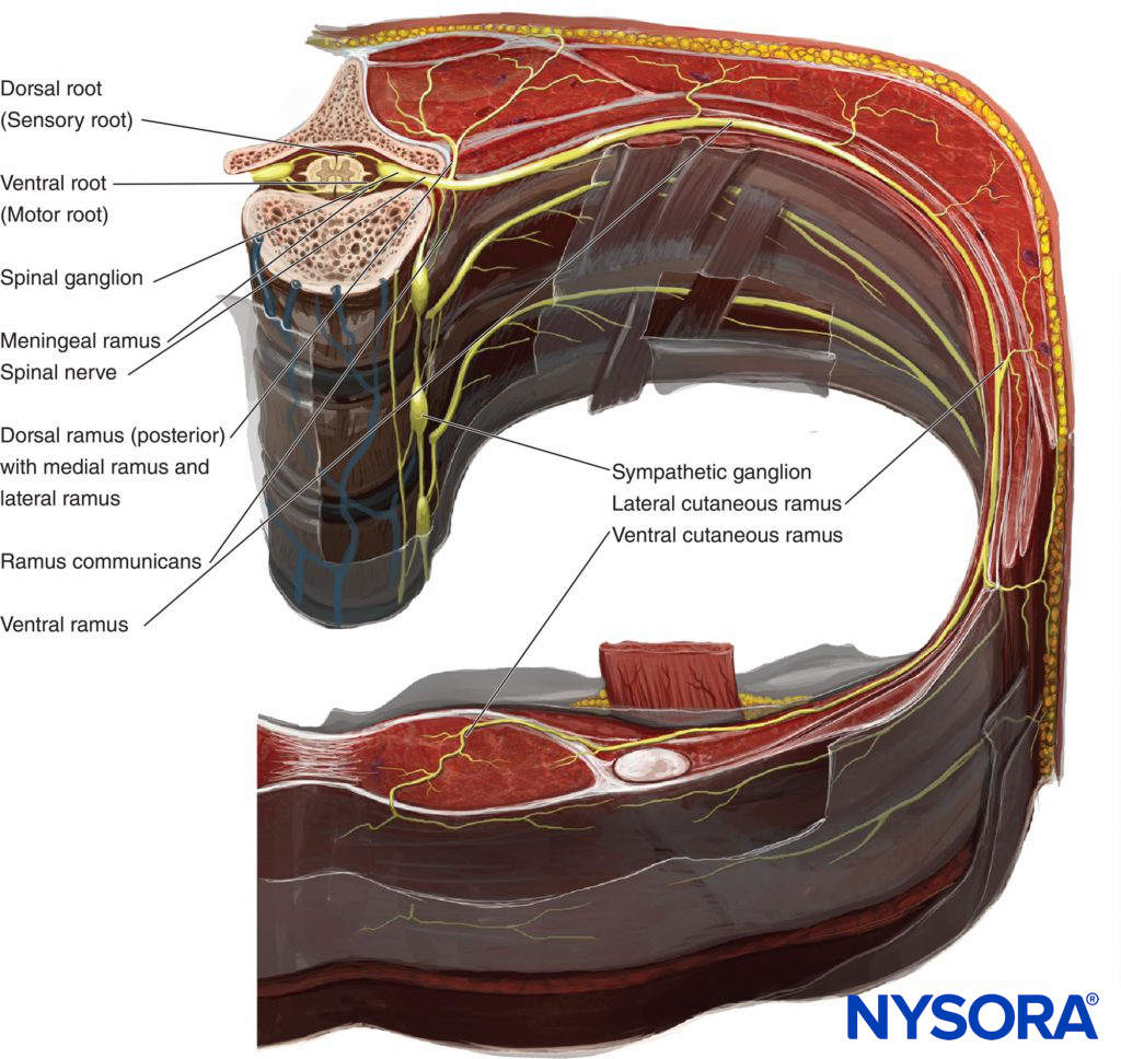 Crossectional anatomy of the vertebra and chest wall demonstrating relationship of paraveretbral space, sympathetic ganglia, spinal and intercostal nerves.