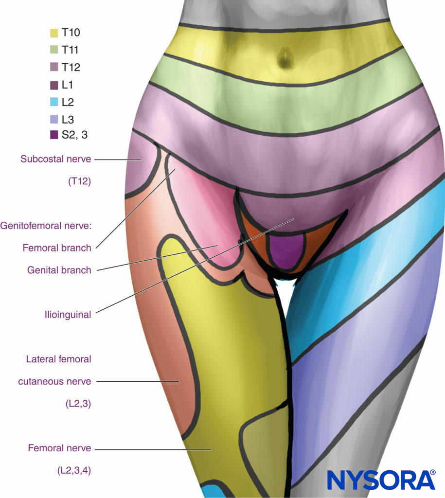 Segmental distribution of anesthesia with lumbar paravertebral levels.