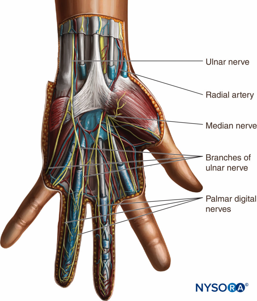 Wrist Block - Landmarks and Nerve Stimulator Technique - NYSORA