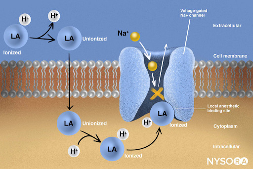 Farmacologia clinica degli anestetici locali - NYSORA