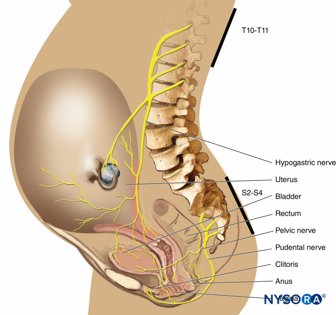 Anesthésie régionale obstétricale - NYSORA