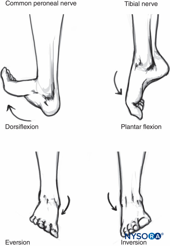 Motor responses obtained on stimulation of the sciatic nerve in the popliteal fossa