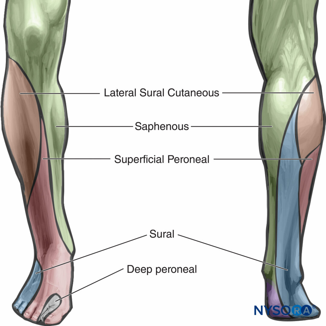 Popliteal Nerve Block Distribution Popliteal Nerve Block Distribution