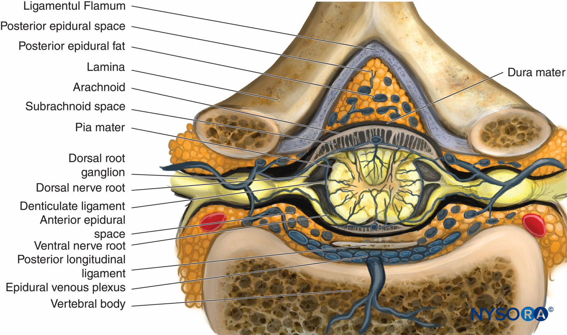 Epidural Anesthesia and Analgesia - NYSORA